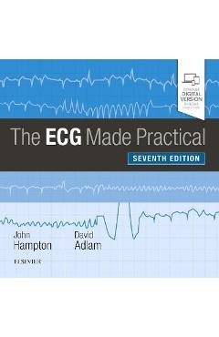 ECG Made Practical