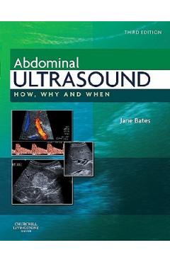 Abdominal Ultrasound: How, Why and When - Jane Bates