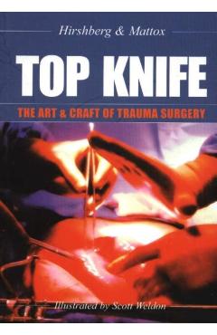 Top Knife