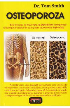 Osteoporoza - Tom Smith