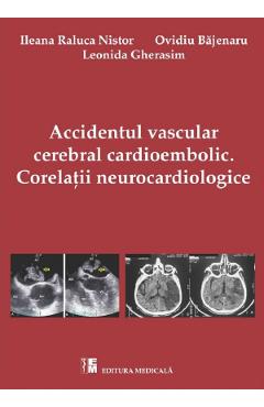 Accidentul vascular cerebral cardioembolic. Corelatii Neurocardiologice - Ileana Raluca Nistor