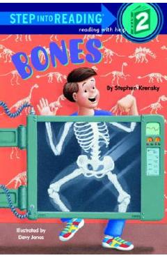 Bones