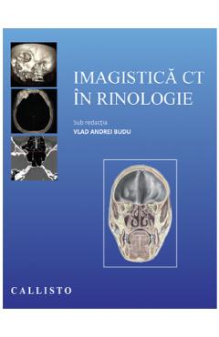 Imagistica CT in rinologie - Vlad Andrei Budu