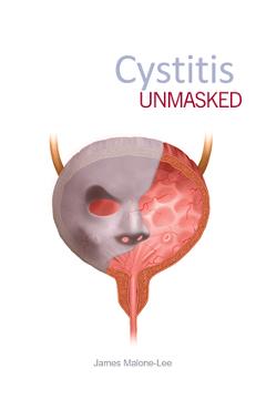 Cystitis Unmasked - James Malone-lee