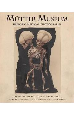 Mutter Museum Historic Medical Photographs: The College of Physicians of Philadelphia - Laura Lindgren