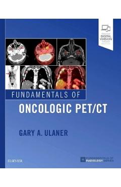 Fundamentals of Oncologic PET/CT – Gary Ulaner Beletristica imagine 2022