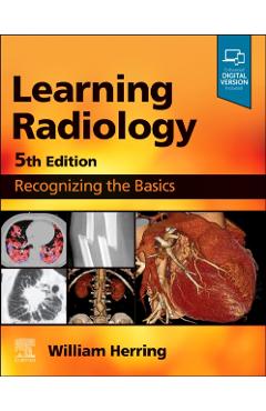 Learning Radiology: Recognizing the Basics - William Herring - Imagine 1