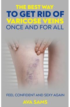 The Best Way to Get Rid of Varicose Veins Once and For All: Feel Confident and Sexy Again: Feel confident and sexy again