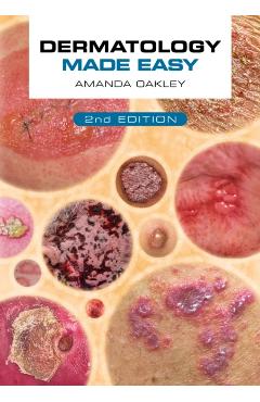Dermatology Made Easy, Second Edition - Amanda Oakley - Imagine 1