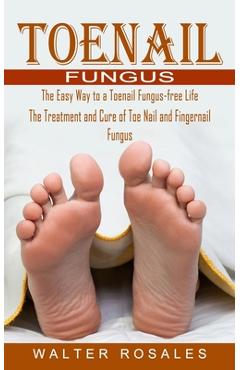 Toenail Fungus: The Easy Way to a Toenail Fungus-free Life (The Treatment and Cure of Toe Nail and Fingernail Fungus) - Walter Rosales