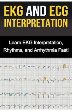 EKG and ECG Interpretation: Learn EKG Interpretation, Rhythms, and Arrhythmia Fast! - Alyssa Stone