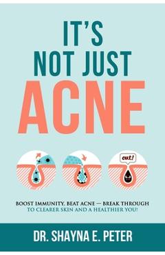 It\'s Not Just Acne: Boost Immunity, Beat Acne - Break Through to Clearer Skin & A Healthier You! - Shayna E. Peter