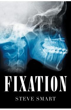 Fixation - Steve Smart