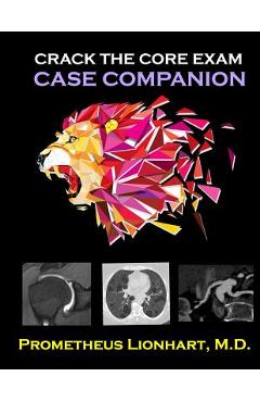 Crack the CORE Exam - Case Companion - Prometheus Lionhart M. D.