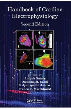 Handbook of cardiac electrophysiology - andrea natale