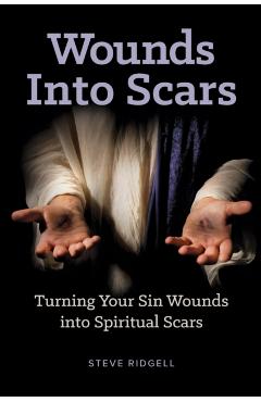 Wounds Into Scars: Turning Your Sin Wounds into Spiritual Scars - Steve Ridgell