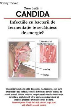 Cum tratam candida - Shitley Trickett - ANTET REVOLUTION
