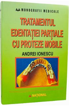 Tratamentul edentatiei partiale cu proteze mobile - Andrei Ionescu