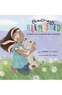 Beautifully Blemished: Learning and Celebrating Skin Differences - Leanne Stuckey