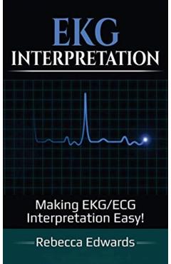 EKG Interpretation: Making EKG/ECG Interpretation Easy! - Rebecca Edwards