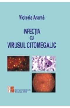 Infectia cu virusul citomegalic - Victoria Arama
