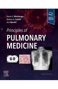 Principles of Pulmonary Medicine - Steven E. Weinberger