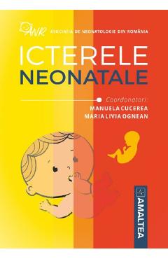 Icterele neonatale - Manuela Cucerea, Maria Livia Ognean