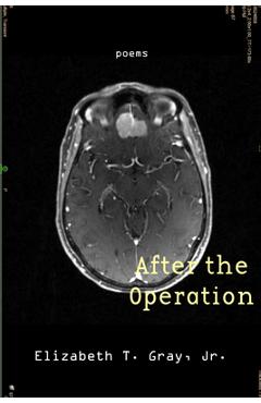 After the Operation - Elizabeth T. Gray