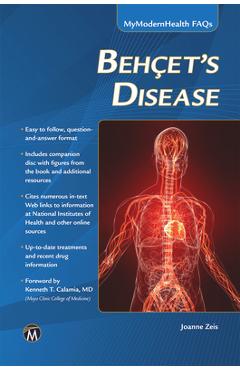 Behcet's Disease - Joanne Zeis