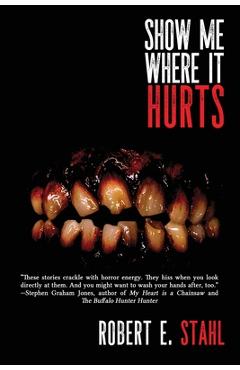 Show Me Where It Hurts - Robert E. Stahl