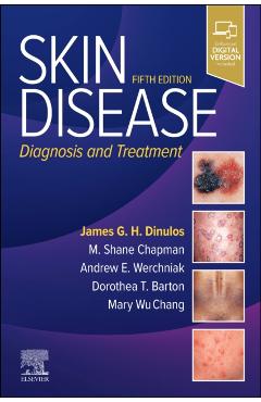 Skin Disease: Diagnosis and Treatment - James G. H. Dinulos